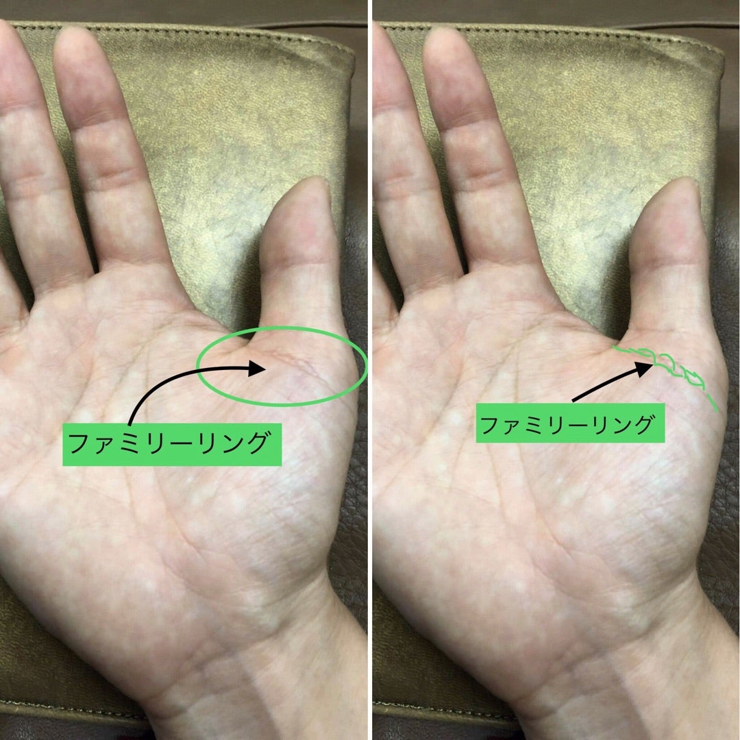 ファミリーリング - 親指の付け根を囲む鎖状の線手相占いスタークローラ