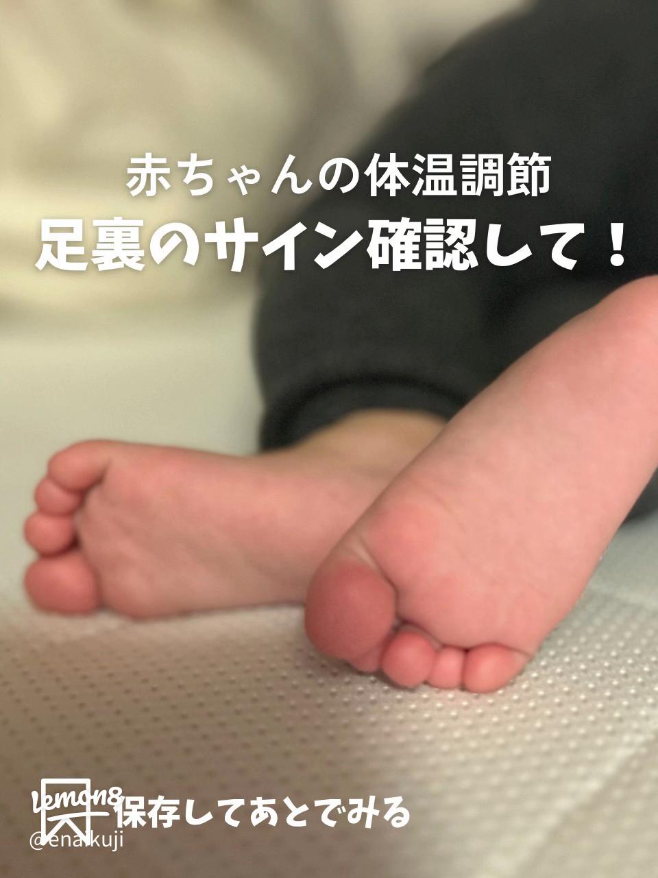 赤ちゃん股関節「脱臼してるかも」 痛みもなく元気に動くのになぜ