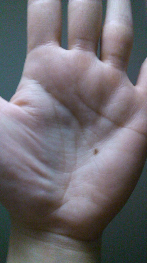 新生児のほくろについて知ろう！注意が必要なほくろや除去方法 - teniteo テニテオ