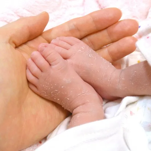 生まれつきのあざ・青あざが消えない宇都宮市のたかだ形成外科クリニック