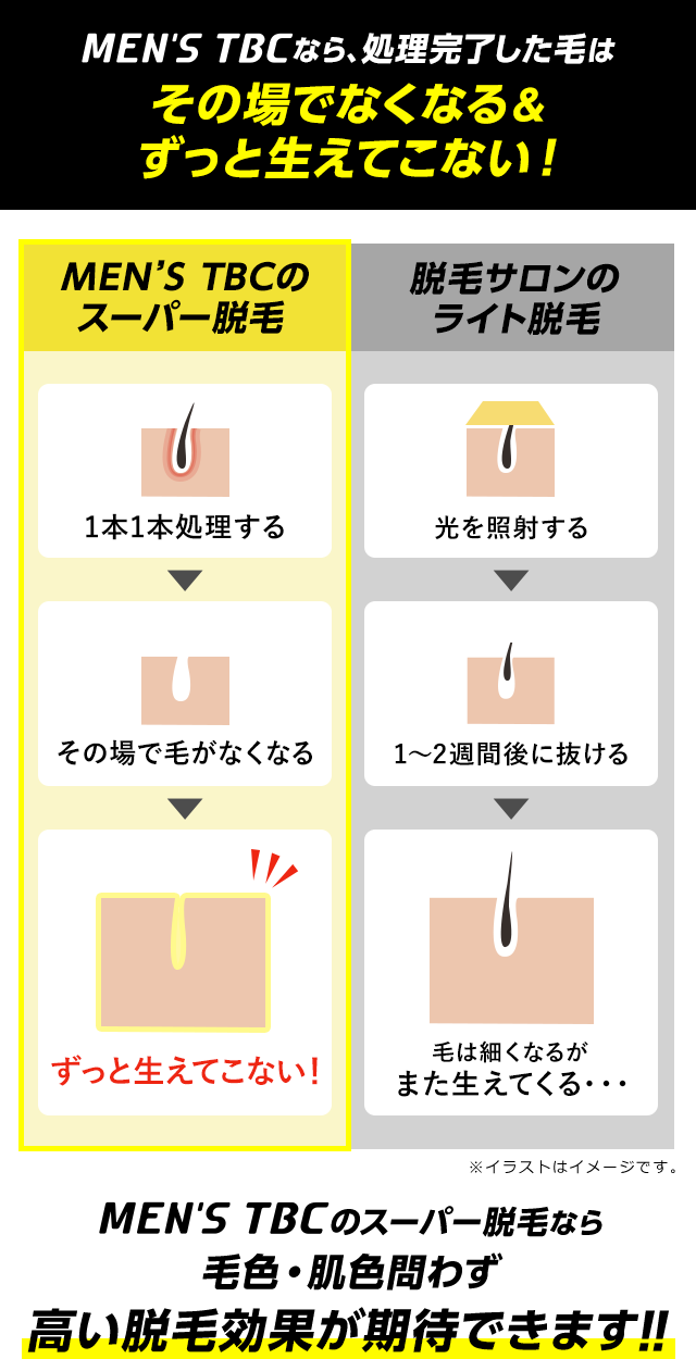 メンズTBCのヒゲ脱毛を1,000円で体験！脱毛後の腫れやセールスの有無を徹底検証｜DanLead