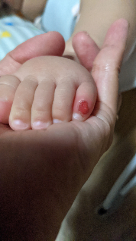 3ヶ月の赤ちゃんです。よく足の指がこのように開いてるのですが何故でしょうか？- Yahoo!知恵袋