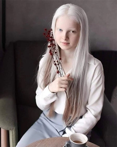 オッドアイとアルビノ、2つのスペシャルを持って生まれたチェチェンの美しい少女 ロシア2020年5月16日- エキサイトニュース