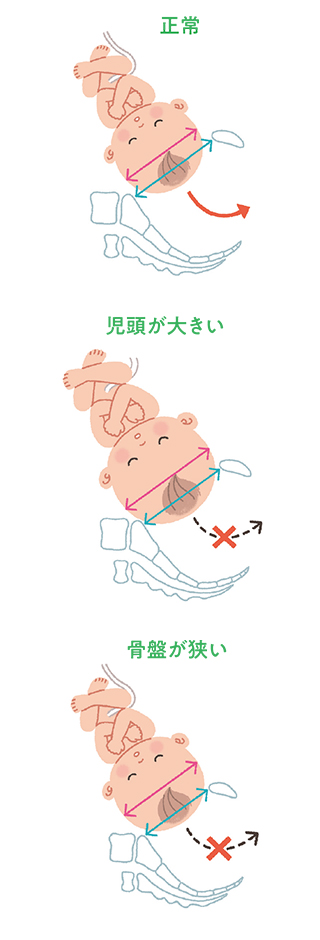 医師監修 臨月はいつから？赤ちゃんの様子・過ごし方・よくある症状を解説トモニテ