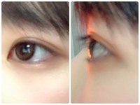 医師監修 奥目の特徴や原因、治す方法などを美容外科医が解説公式コラム美容整形・二重整形なら共立美容外科