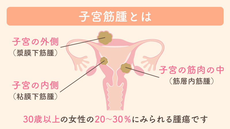 銀さんがお勧めしてしたおもちゃ買ったけど 全然気持ちよくならないです | Peing