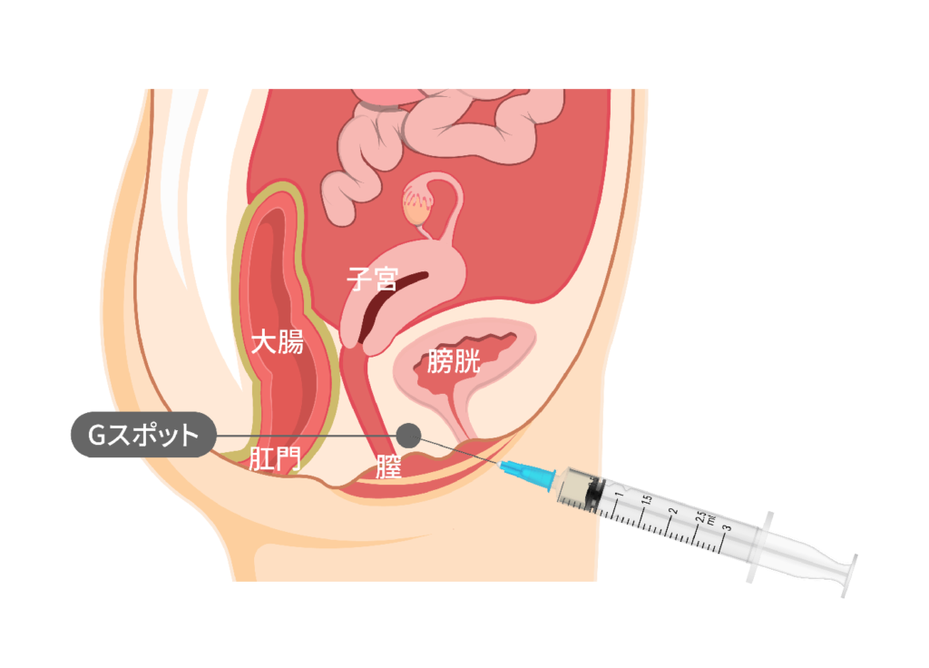 【完全図解】女性のGスポットの正しい刺激方法３STEP