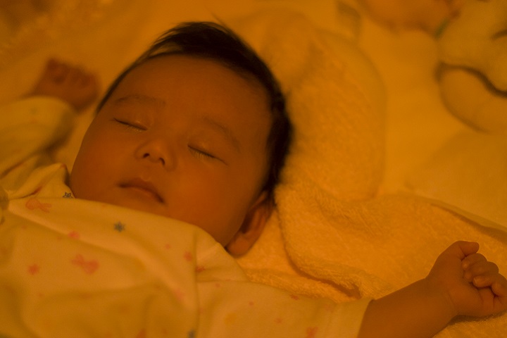 医師監修 赤ちゃんの向き癖を直すには？頭のゆがみの影響や対策について - 赤ちゃんの頭のかたち相談室