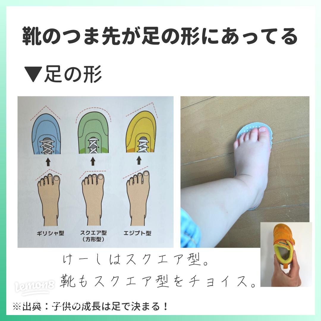 子どもの足指がねじれている？！カーリートゥ 巻き趾 ってどんな足