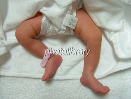 赤ちゃんの足赤ちゃんの足の爪、見たことありますか？？ 親指だけでなく、 人差し指からから小指まで爪がしっかりしています。小指だけ、爪が小さい爪をいつ切ったか分からない爪が伸びないそんな方いませんか？ 爪は足の状態を表現してくれますので