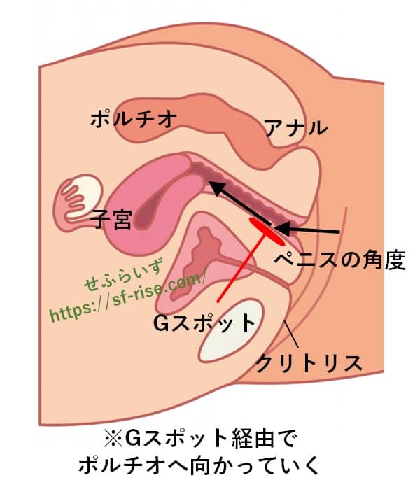 シリコンバック豊胸術｜銀座美容外科クリニック｜美容皮膚科・美容整形