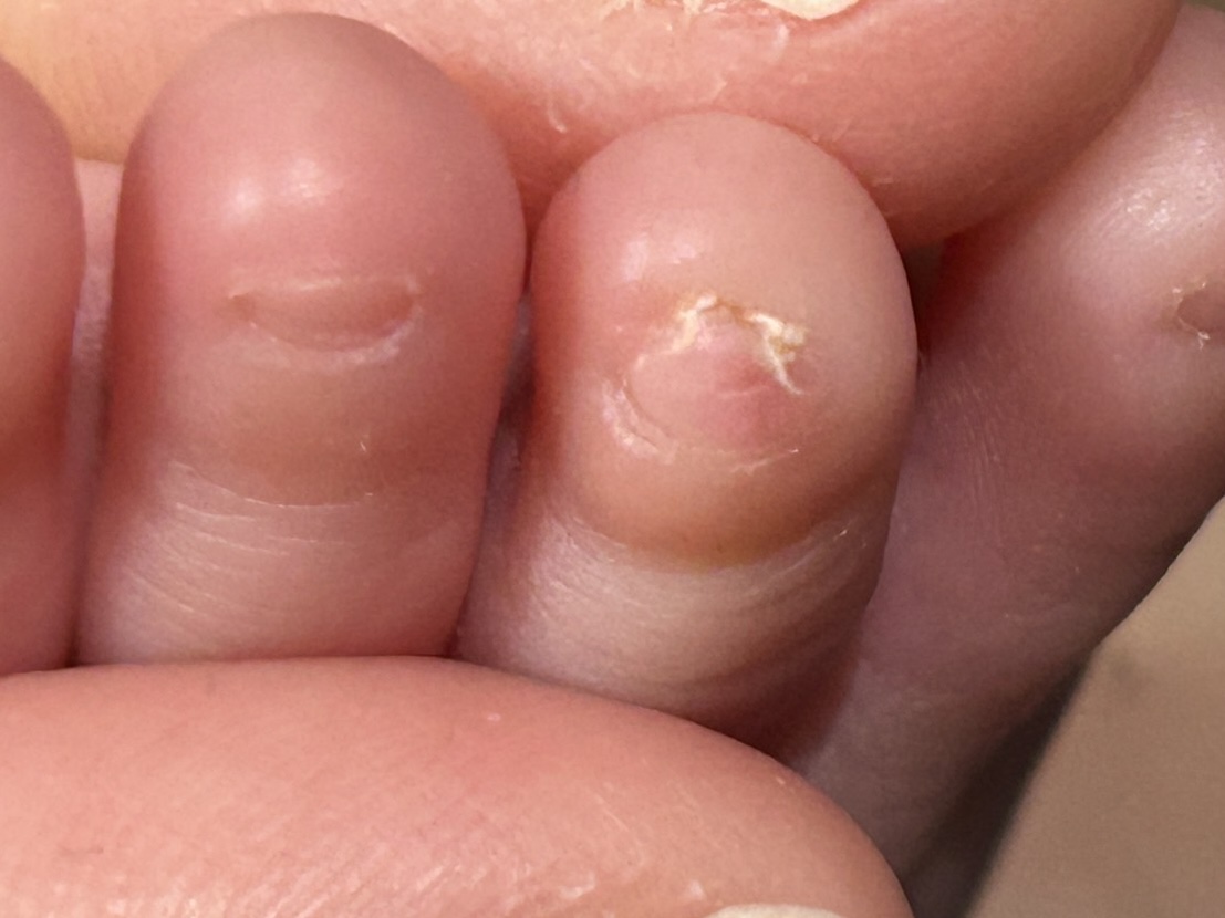 院長コラムこどもとかぞくの整形外科よしだクリニック