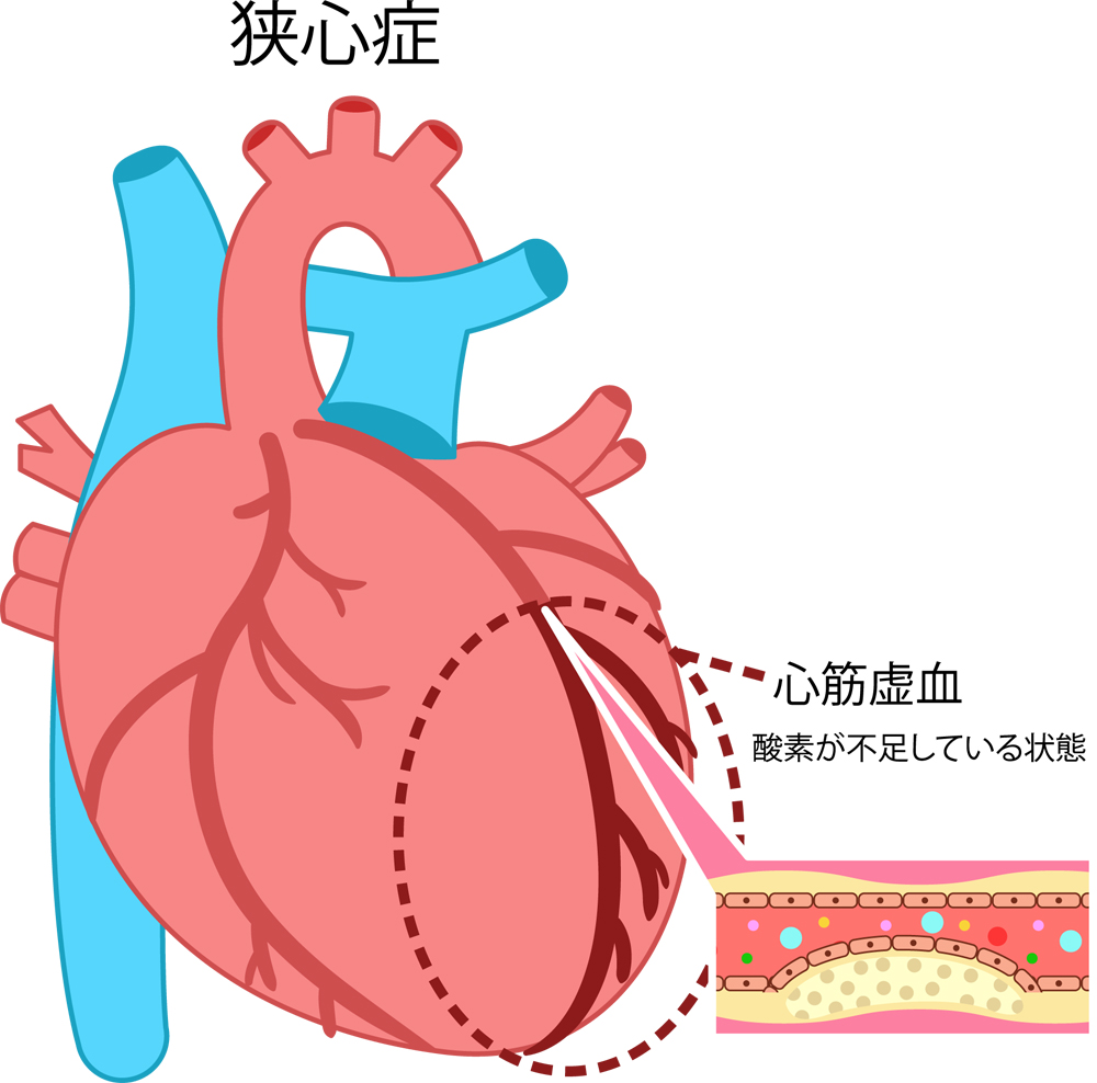 吐き気・おう吐の原因まとめ 病気や食中毒、薬の副作用など - きょうの健康