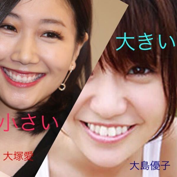 前歯が大きいコンプレックス」の原因！小さくする治療の選択肢を解説