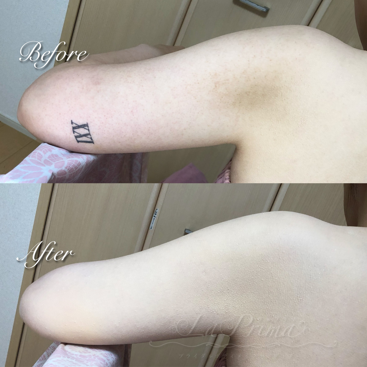 ブライダルタトゥーカバー タトゥー隠し のお客様でございます♪ 結婚式の前日にご利用頂きました♪ タトゥーの箇所により、タトゥー特有の凹凸があり、 タトゥー範囲も広かったですが、花嫁様のお肌の色に合わせしっかりとカバーできました♪ お背中の小さな痣も一緒に