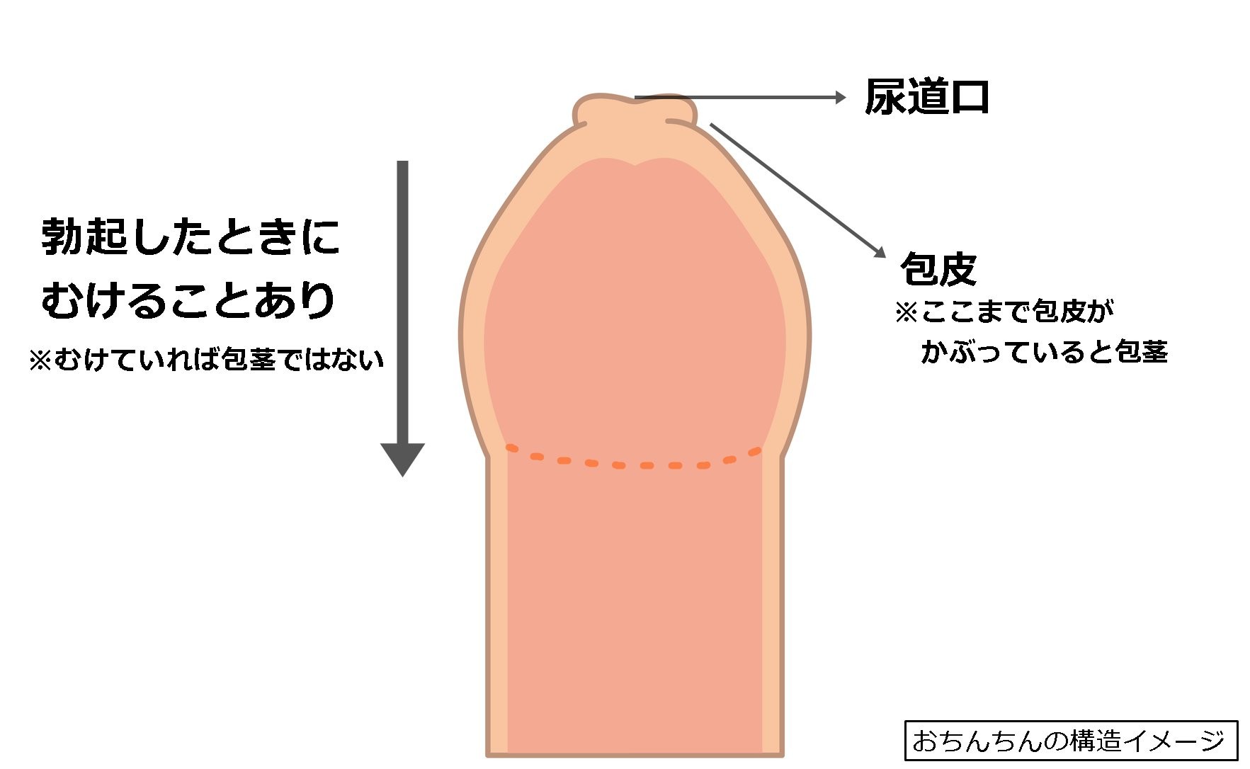 ○送料無料○下向用ペニスト(前カバー付) タイプ：ノーマル サイズ：Ｓ/Ｍ/Ｌ