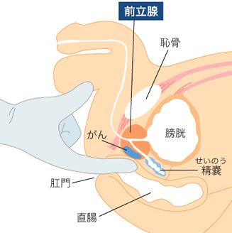 前立腺を一番刺激できる姿勢シリーズ | エネマグラ（ENEMAGRA）公式サイト