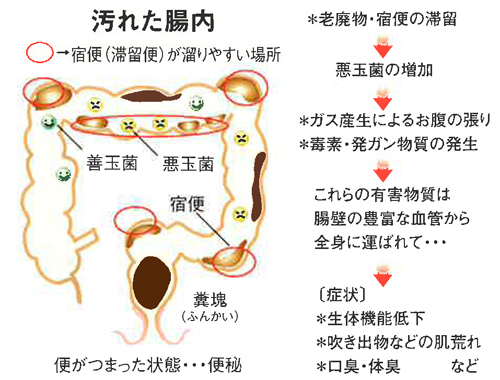 コンチネンタルクラブ ベルフランセ（コンチネンタルクラブベルフランセ）［栄町 ソープ］｜風俗求人【バニラ】で高収入バイト