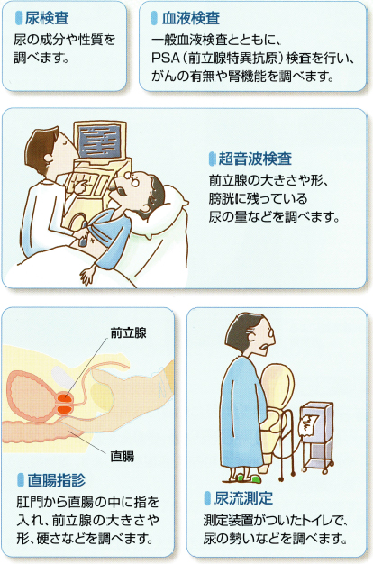 【1日3分】慢性前立腺炎を解消するためのストレッチ！3つのポイントが大事！