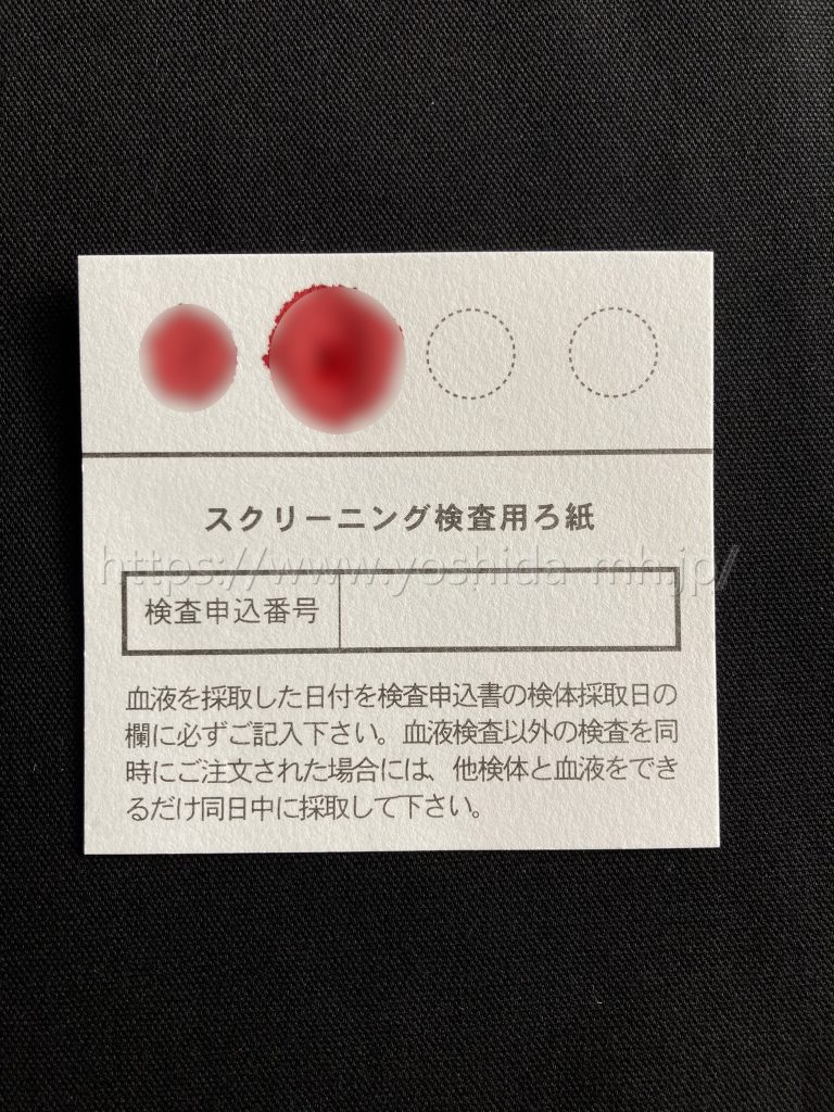 信頼性は？GME医学検査研究所の口コミ評判を徹底調査！