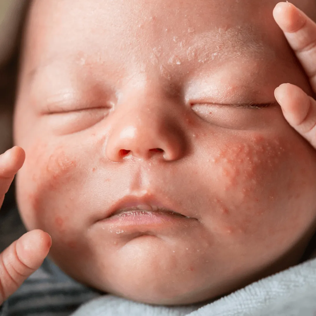 おくるみに包まれている生後2ヶ月の赤ちゃんの顔 写真素材6559388- フォトライブラリ