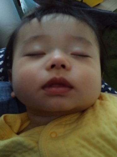 子どもの舌の位置が低いと歯並びにどう影響する？ イラスト解説- 子ども専門の歯ならび・矯正なら大田区田園調布のABC Dental