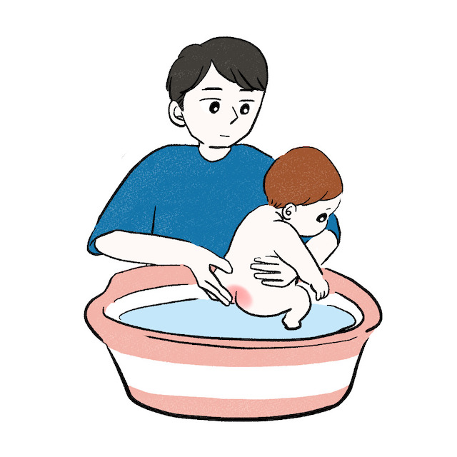 赤ちゃんのうんちの色からわかること - 小児科オンラインジャーナル