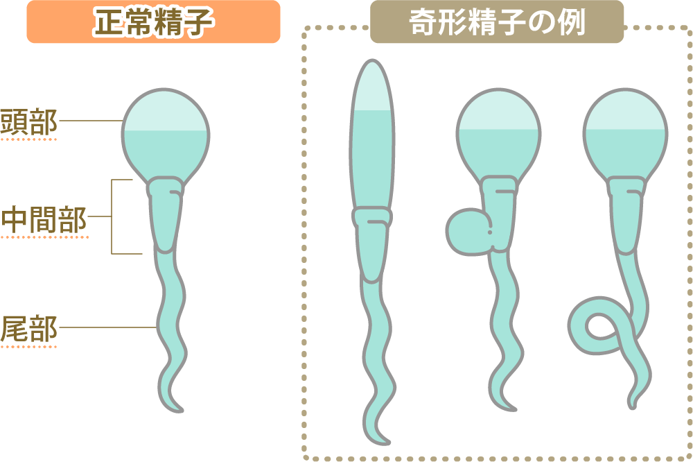 妊活中の男性が食べてはいけないものとは？精子に影響する3つの食べ物と摂るべき栄養素を紹介 | mitas series