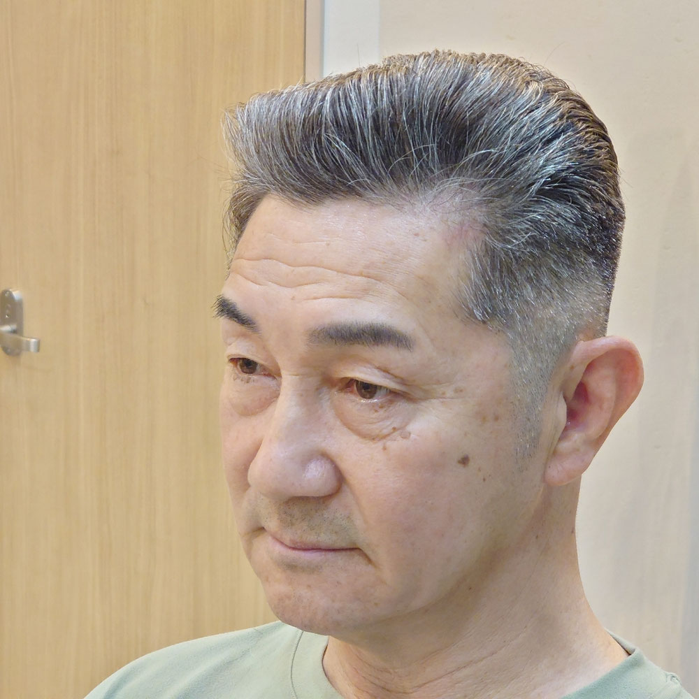 ハゲ薄毛ヘアスタイルに悩む高齢者男性おじいちゃんの写真・画像素材-Snapmart スナップマート