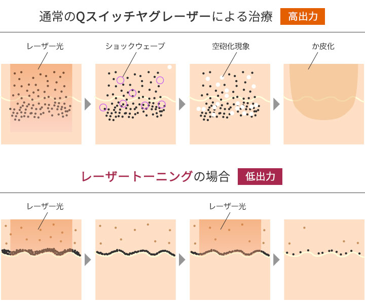 デリケートゾーンの黒ずみケアの市販クリームおすすめランキング21選【原因と治し方とは？】