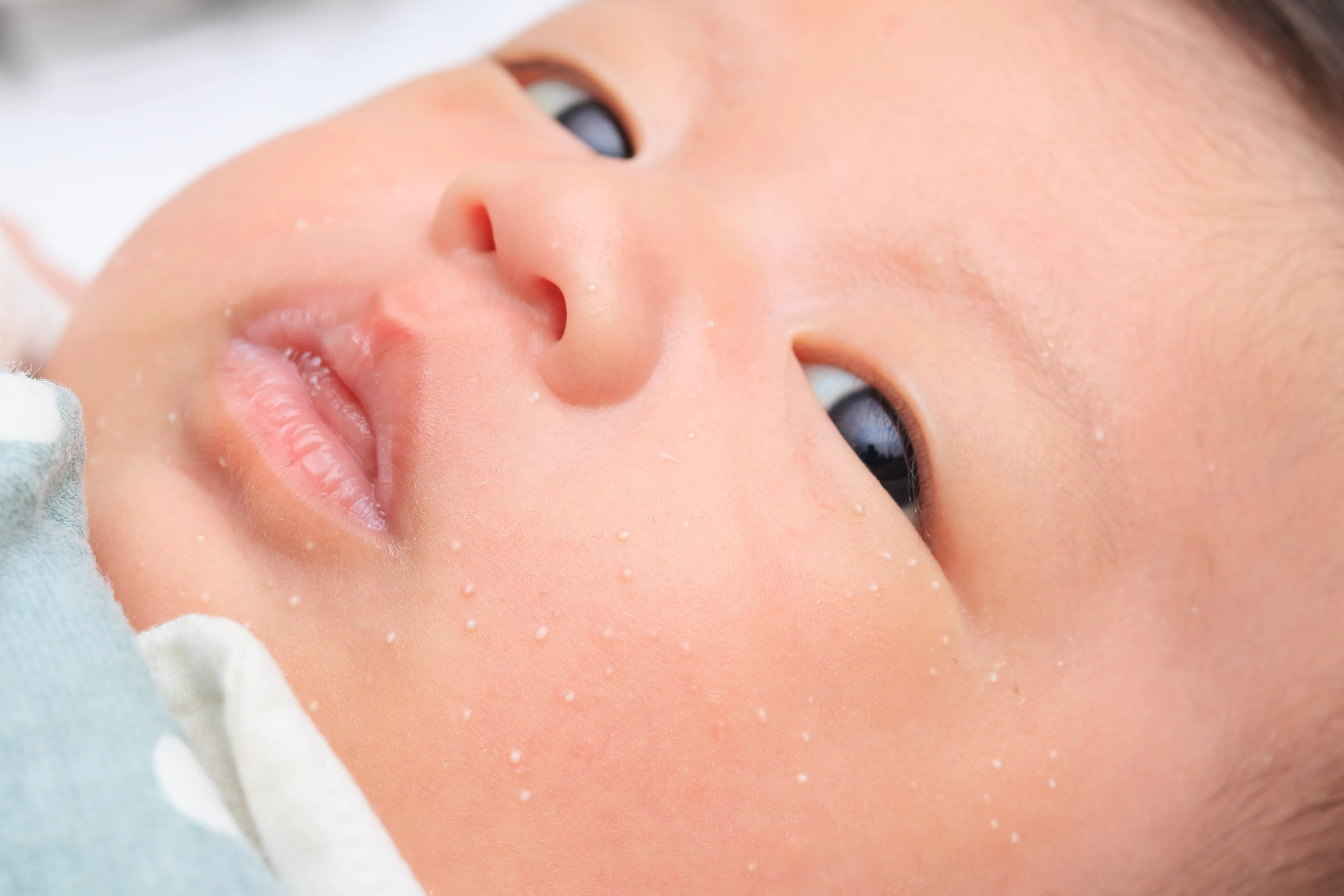 乳児湿疹いつまで続く？原因と治し方・スキンケアたなか小児科アレルギー科