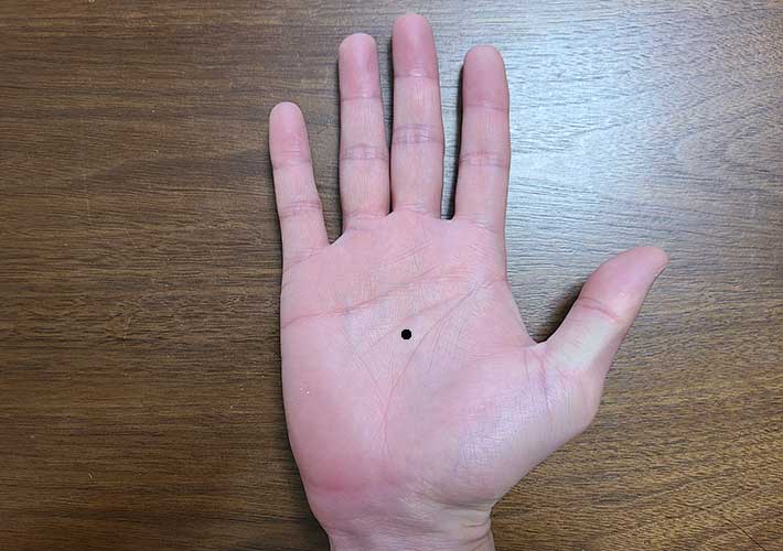 小児科皮膚科福岡市西区の皮膚科・美容皮膚科『九大学研都市かえで皮膚科』糸島市隣