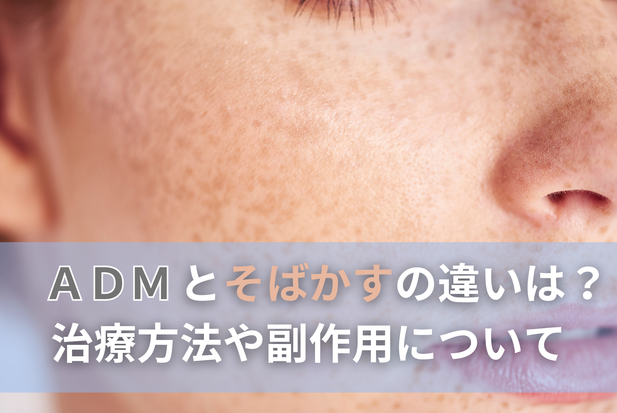 痩せぎすのそばかすだらけのかわいい女の子の顔の肖像画を閉じるの写真素材・画像素材 Image 5285054