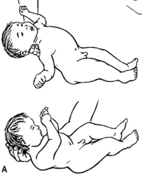 今週のリハビリ〜寝返りの準備新生児脳梗塞のあっちゃん