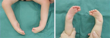 赤ちゃんの足ってどんな足