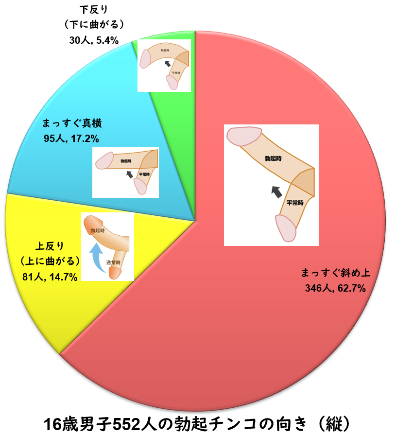 屈曲・湾曲ペニス修正 ペロニー病治療 -