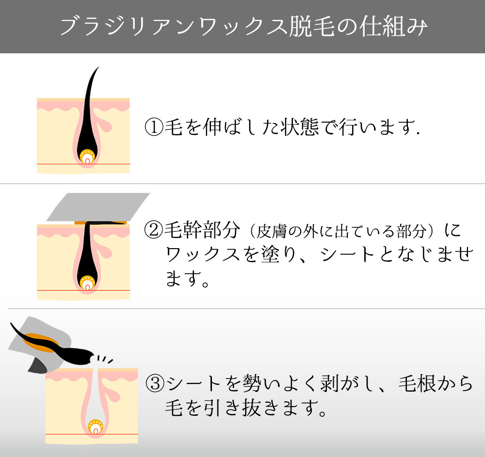 Amazon.co.jp: BABYWAX ワックス脱毛シート