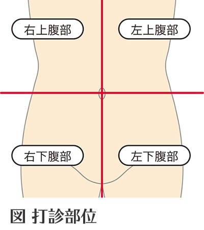 白血病の種類｜おしえて 白血病のコト【中外製薬】