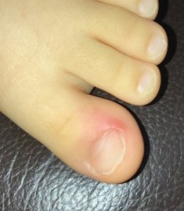 爪」に横線がある方、要注意です！健康セルフチェックTBSテレビ