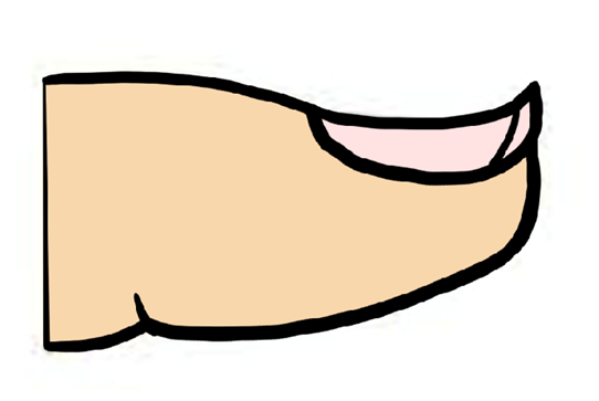 子どもの足指がねじれている？！カーリートゥ 巻き趾 ってどんな足