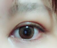 出目vs奥目圧倒的に奥目の方が美人。 特に差が出るのは横顔。 Aの線 引用2枚目のお写真 が奥目の方が長く見えるから、顔に立体感が出て美しく見える。奥目はオージーカーブまで綺麗出目のメリットなんて ・埋没二重定着しやすい ・目に光が入りやすい ・涙袋でき