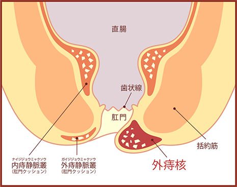 楽天市場】お尻 穴の通販