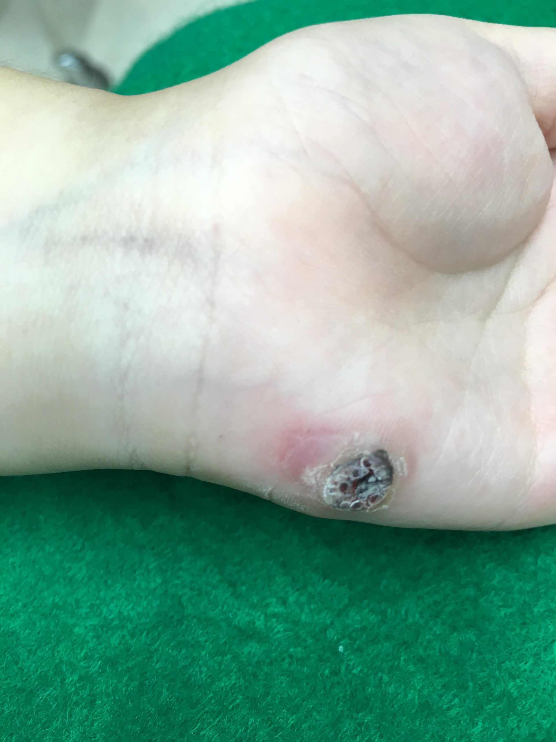 できものやぶつぶつがある田無皮フ科コンタニクリニック皮膚科・小児皮膚科・交通事故 整形外科部門西東京市 田無駅