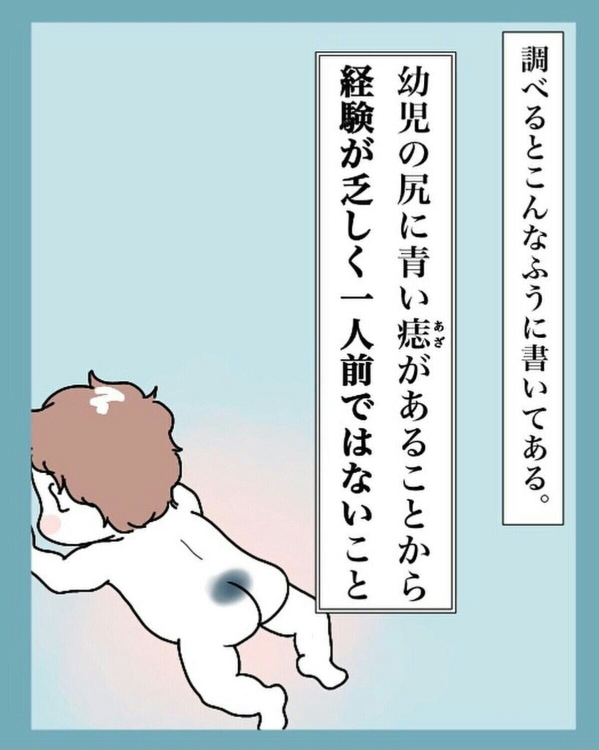 子どもの青あざは早く治す必要があるの？異所性蒙古斑と太田母斑の治療について詳しく解説皮ふと子どものあざクリニック茗荷谷