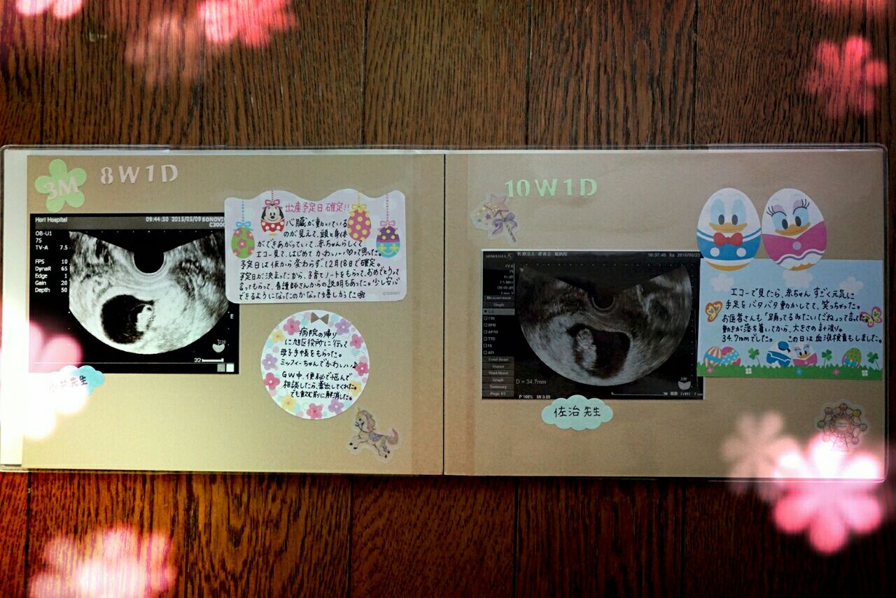 手作りアルバム ジャバラ 台紙 貼るタイプ エコー写真 スクラップブック フォトアルバム 手作り じゃばらブラックブラック- メルカリ