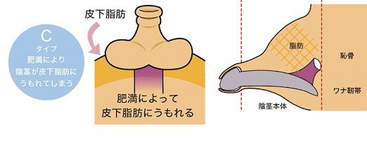 剥くと皮が余るのは気持ち悪い！