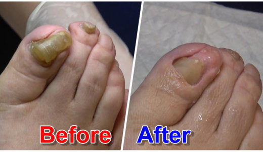 歩き始めの赤ちゃんには「足裏爪刺激」で踏ん張り力を記憶させる笠原巌の「子供の足と健康」専門サイト