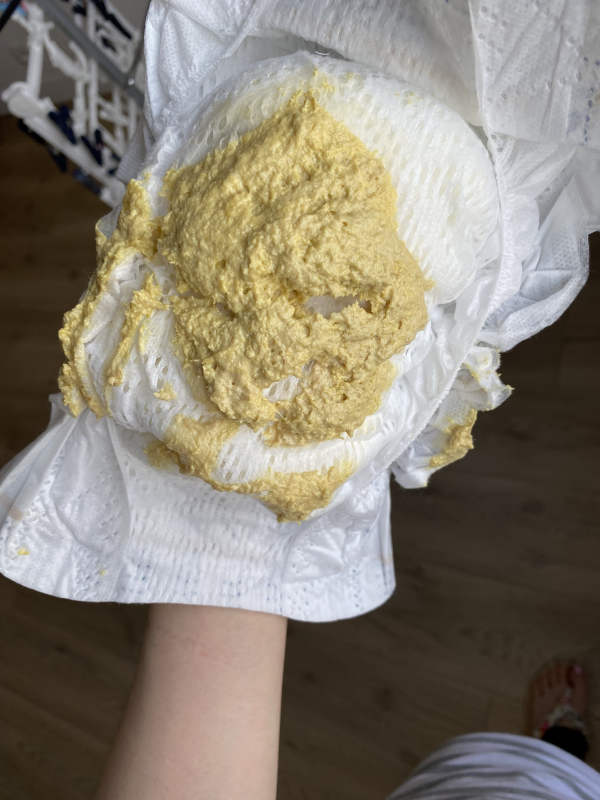 便の色はおなかのバロメーター！院長ブログいさか内科・消化器内視鏡クリニック 静岡県磐田市2023年6月に開院の内科・消化器内視鏡クリニック