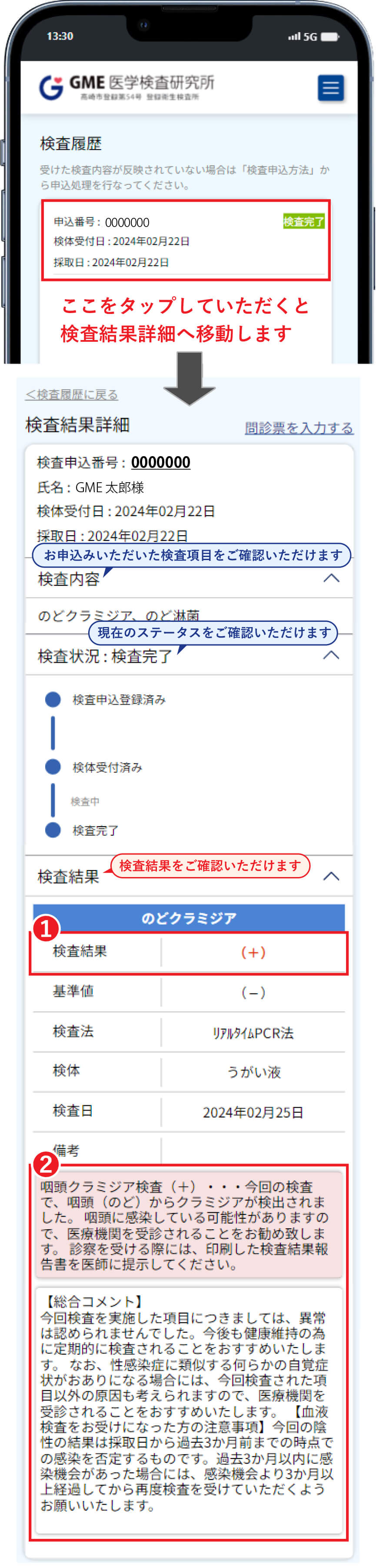 検査結果確認 - 性病検査キット（郵送）クラミジア・梅毒・HIVなど自宅で簡単検査