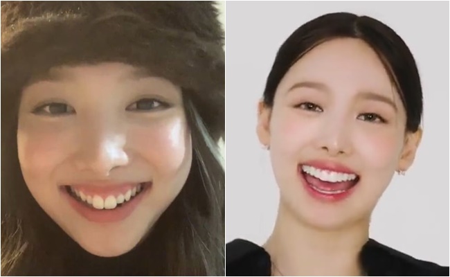 歯のアップデート”で別人級変身した芸能人のビフォーアフター “出っ歯”に悩んだモデルが掛けた金額は？ - 1ページ目 - エンタメ - コラムクランクイン